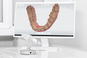3Shape Trios Digital Scanner